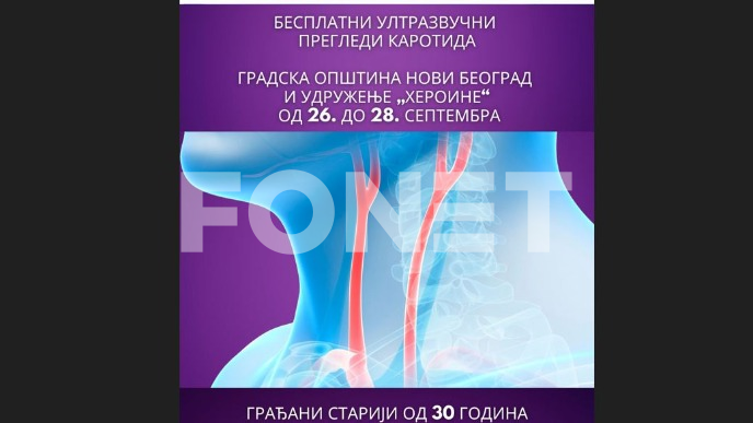 Besplatan pregled karotida
